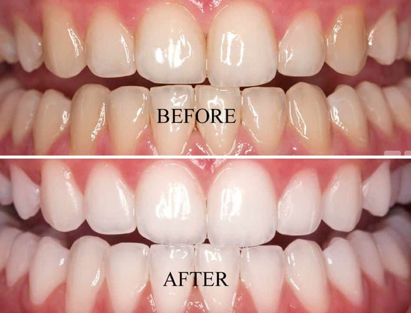 Cosmetic Dentistry - Main View